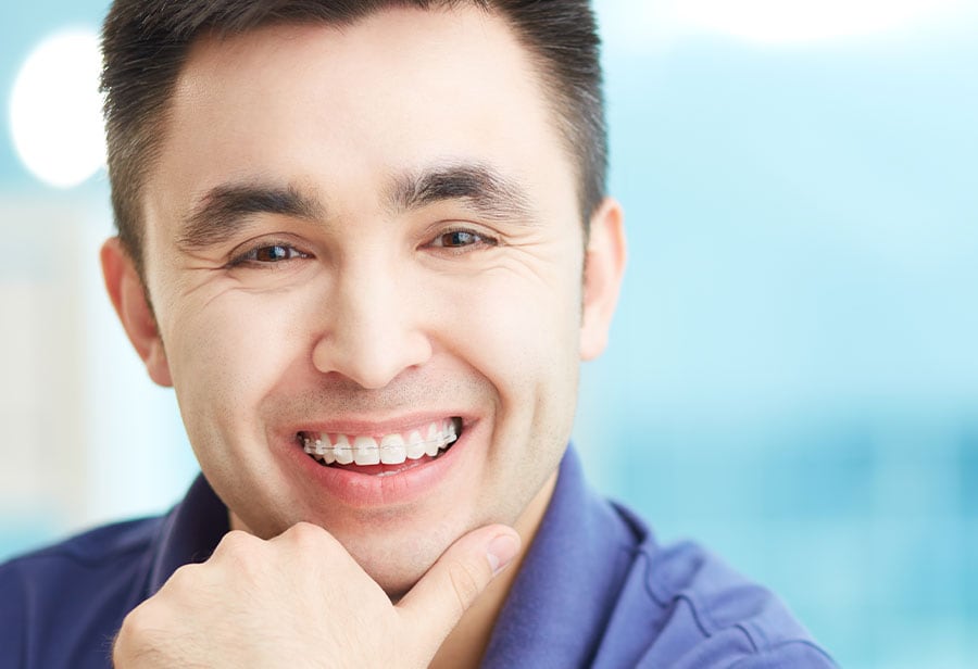 Clear / Ceramic Braces, Tooth-colored Braces in Lisle, IL